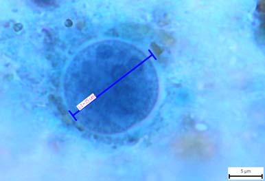 VZOREK E: cysty Entamoeba coli ZÁVĚR: K maximálnímu zisku 8 bodů se dopracovalo 51 (78,5 %) pracovišť.