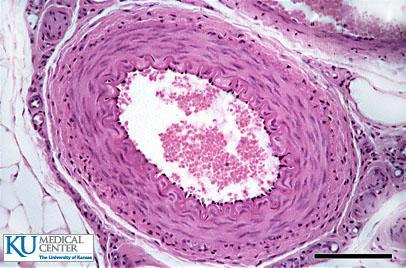 Obrázek 2: Mikroskopický preparát cévní stěny http://www.kumc.edu/instruction/medicine/anatomy/histoweb/vascular/vasc06.htm (15. 4. 2013) Tunica intima Tunica intima je vnitřní vrstva cévní stěny.