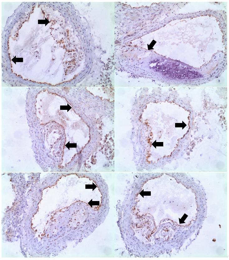 Obrázek 13: Reprezentativní obrázky imunohistochemického barvení enos u kontrolní skupiny zvířat.