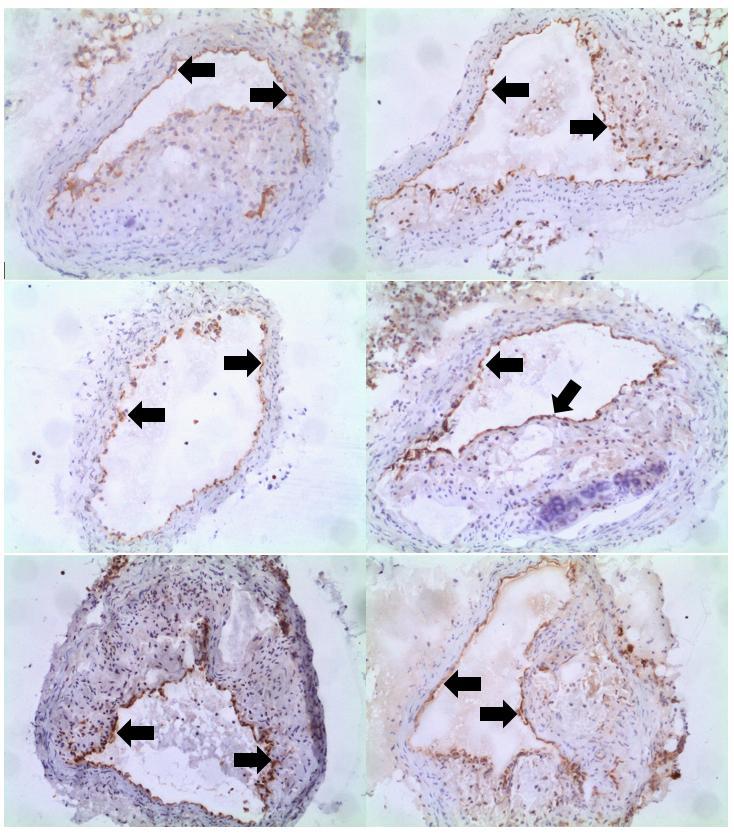 Obrázek 14: Obrázky imunohistochemického barvení enos u LCHP skupiny zvířat Exprese enos se