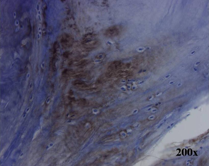 Obrázek 5 - Histologický nález z oblasti inzerce ţlutého vazu na oblouk obratle.