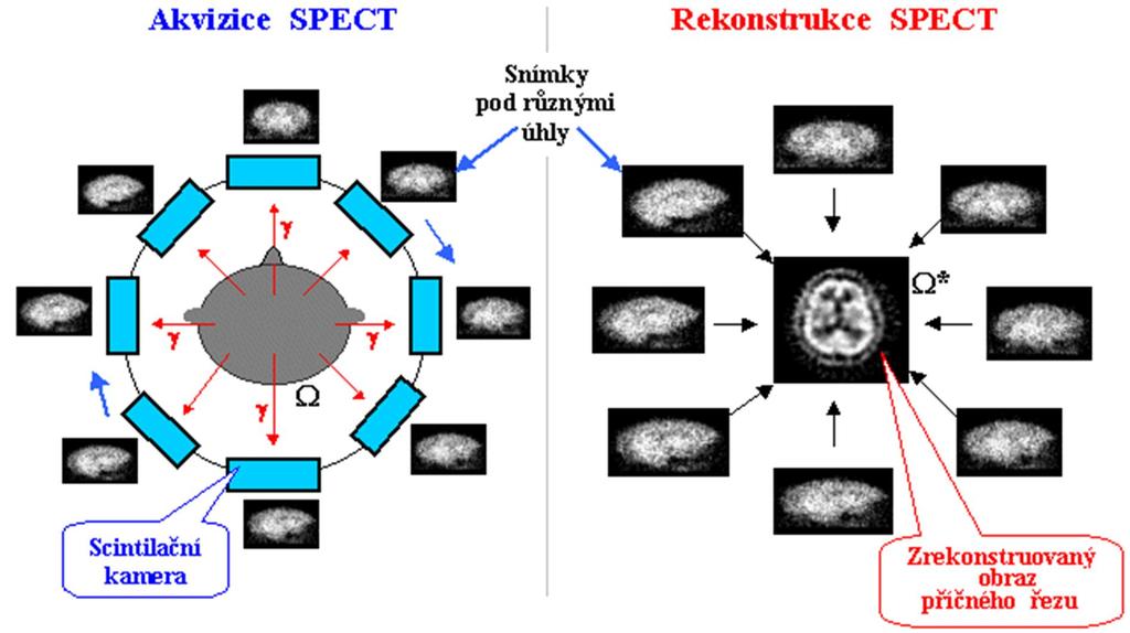 htm> Příloha 4 - Schéma přenosu a záznamu informace o distribuci radiofarmaka v těle pacienta scintilační