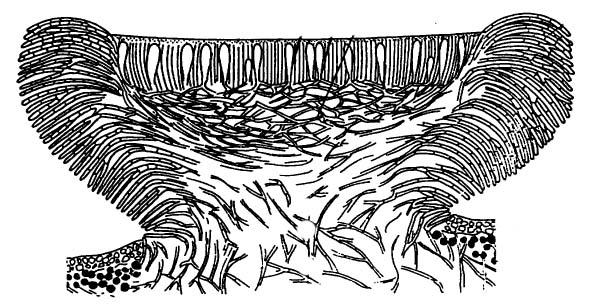 schema lecideového typu apothecia Lecidea sp.