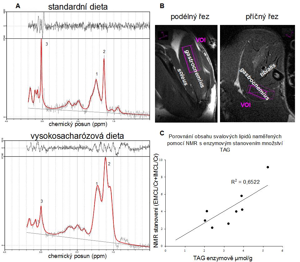 Obrázek 2 Stanovení svalových lipidů pomocí NMR. A: Typická spektra získaná při stanovení intramyocelulárních lipidů u kontrolních potkanů a u potkanů krmených vysokosacharózovou dietou.