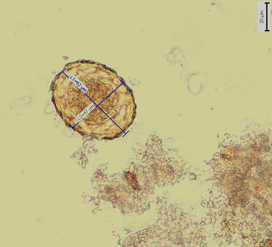 lumbricoides Ojediněle vajíčka Trichuris