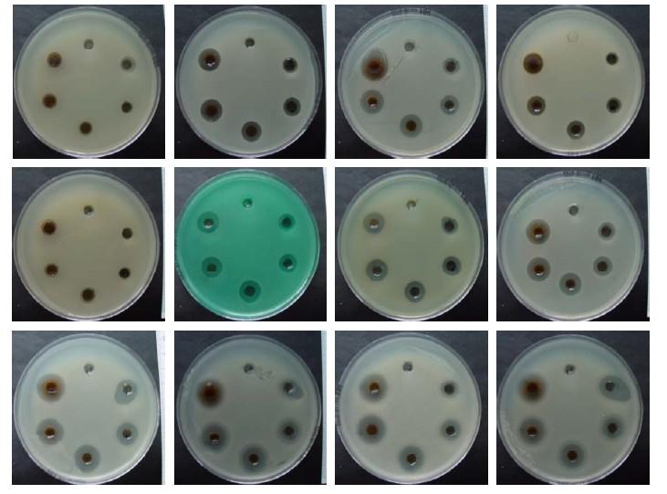 Obrázek 9: Antimikrobní aktivita metylcelulózového hydrogelu s AgNPs a b c d e f g h i j k l (a) Escherichia coli CCM 3954, (b) Staphylococcus aureus CCM 3953, (c) Staphylococcus epidermidis, (d)