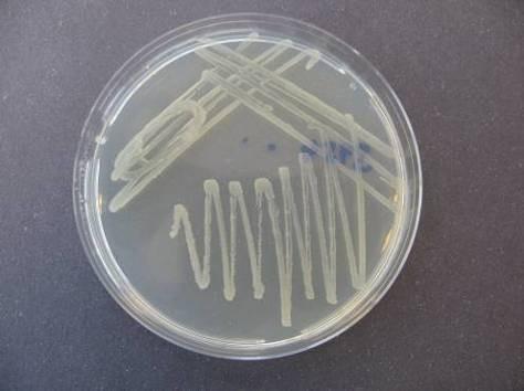 rezistentní Escherichia coli na MH agaru bez obsahu AgNPs (G) a s obsahem