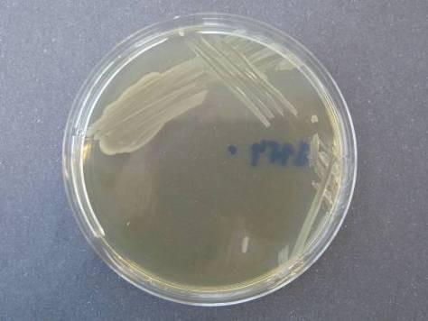Obrázek 12: Růst AgNPs rezistentní Escherichia coli na MH agaru s obsahem 40
