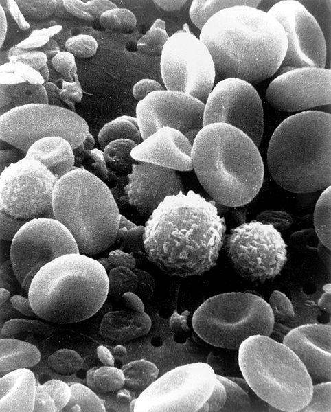 Blood Cells [1] One can see red blood cells, several white blood cells