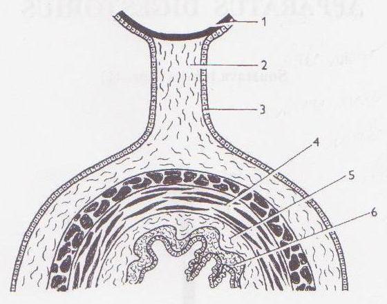 2 Teoretická část 2.1 Anatomie a fyziologie tenkého a tlustého střeva 2.1.1 Obecná stavba stěny trávicí trubice Trávicí trubice začíná dutinou ústní a končí otvorem řitním.