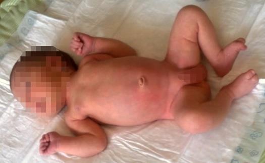 Obrázek 1. Novorozenec v poloze na zádech Novorozenec v poloze pronační Dítě zaujímá asymetrické držení těla. Pohyb probíhá holokineticky. Dominuje flekční držení pánve, kyčelních a kolenních kloubů.