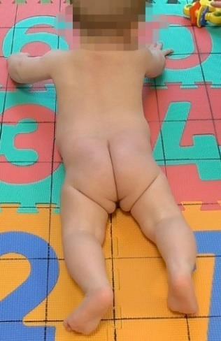 6 měsíců v poloze pronační Dítě zvládá tzv. vysokou oporu (Obrázek 11). Zatíženo na stehnech se opírá o rozvinuté celé dlaně, palce směřují do abdukce. Ramenní klouby jsou v lehké zevní rotaci.