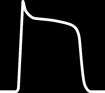 kompenzační pauza (< 2 x R-R), obvykle normální QRS, vlna P