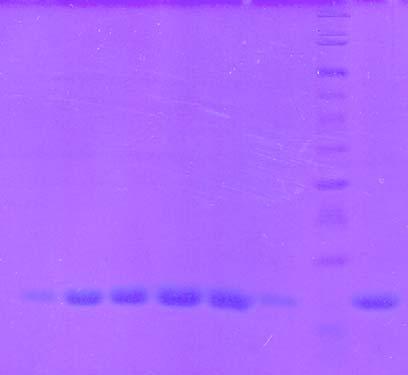 Výsledky a diskuze K identifikaci a ověření čistoty jednotlivých proteinů přítomných ve frakcích získaných chromatografií na DEAE-Sepharose CL6B byla použita SDS elektroforéza (obrázek 31 a 32, str.