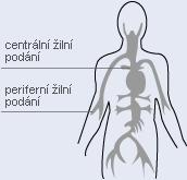 Konkrétní indikace parenterální výživy Nemožnost využít GIT Ileus Střevní píštěle Náhlé příhody břišní Rozsáhlé střevní operace