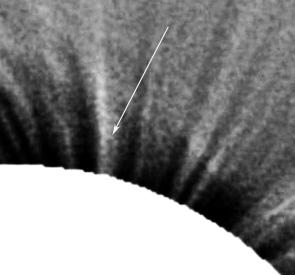 Obr.č.4. Obrázek bílé koróny v oblasti severního pólu z pozorování z Libye v oblasti studovaného polárního paprsku položený na snímku v čáře Fe 17.1 nm (EIT/SOHO). Paprsek je vyznačen šipkou.