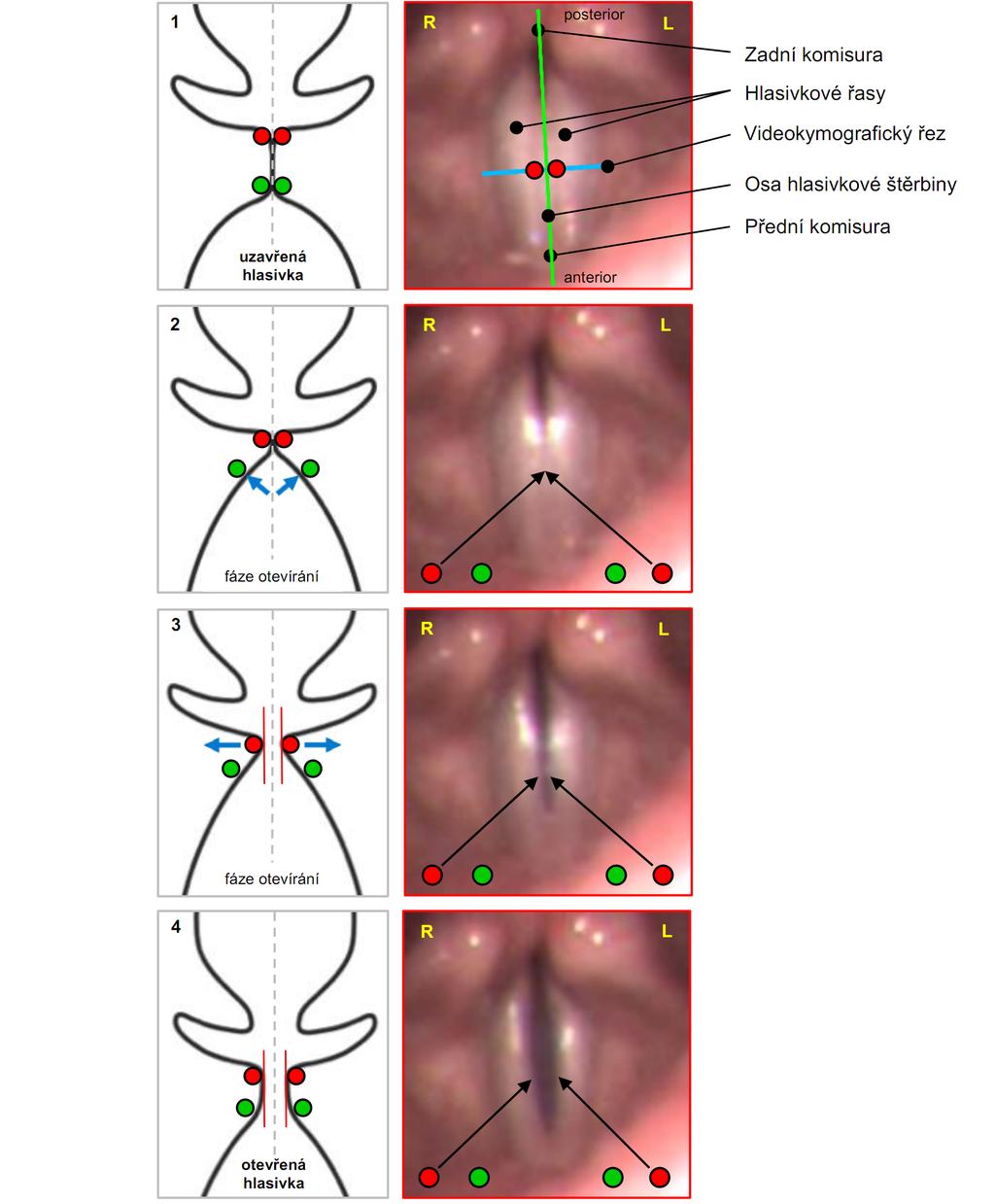 Úvod Anatomie hrtanu a fyziologie hlasu Obrázek 1.5: Popis a rozklad dynamiky hlasivek v průběhu fonační funkce - otevírání (abdukce).