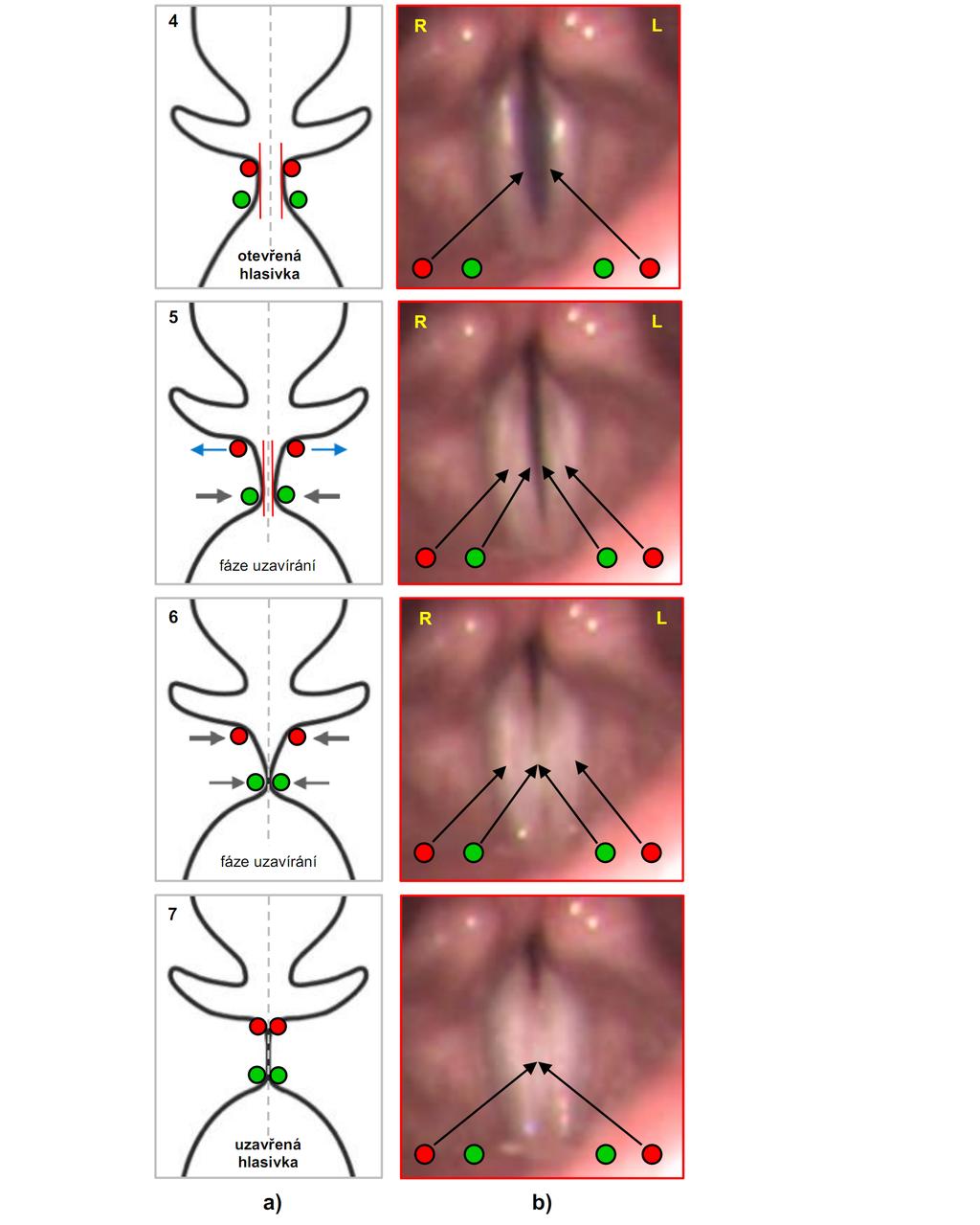 Úvod Anatomie hrtanu a fyziologie hlasu Obrázek 1.6: Popis a rozklad dynamiky hlasivek v průběhu fonační funkce - uzavírání (addukce).