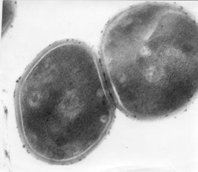 STAFYLOKOKY v elektronovém mikroskopu Ø 0,5-1,5 um nepohyblivé netvoří spóry preferují aerobní atmosféru