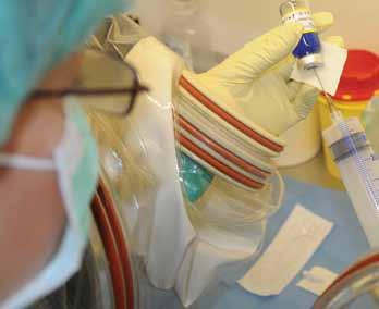 Diagnóza Spolupráce lékárny pri ˇ lécbe ˇ ˇ hepatocelulárního karcinomu Mgr.