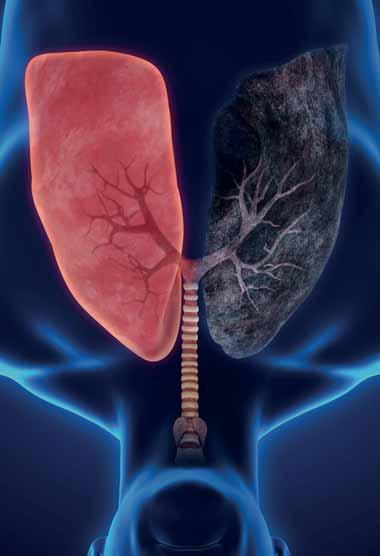 Asthma bronchiale Chronická obstrukční plicní nemoc (CHOPN) Intersticiální plicní procesy (IPP) Rakovina plic Spánková apnoe Plicní rehabilitace Klinika