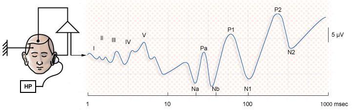 Sluchové evokované potenciály Diagram illustrating the auditory pathway and the anatomical locations related to the the