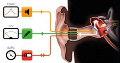 Tympanometrie (impedanční audiometrie) Představuje měření akustické admitance za různých tlakových podmínek v zevním zvukovodu. Akustická admitance je převrácenou hodnotou akustické impedance.