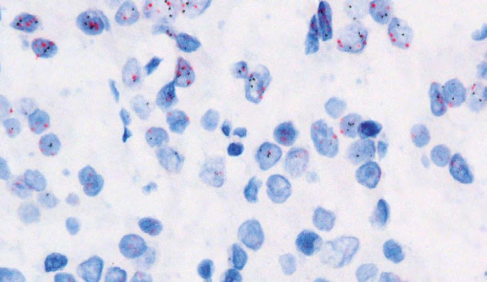 ZKUŠENOSTI Z LABORATOŘÍ Popis jednotlivých vylepšení postupu a jejich významu První změnou, kterou výrobce provedl, bylo zkrácení délky hybridizačních sond na tzv. oligonukleotidové sondy.