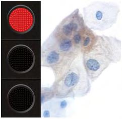 gynekologickou cytologii je již řadu let k dispozici zmíněný test CINtec Plus. Tento test se vyrábí v automatické verzi pro imunohistochemické barvicí automaty Ventana Benchmark i ve verzi manuální.