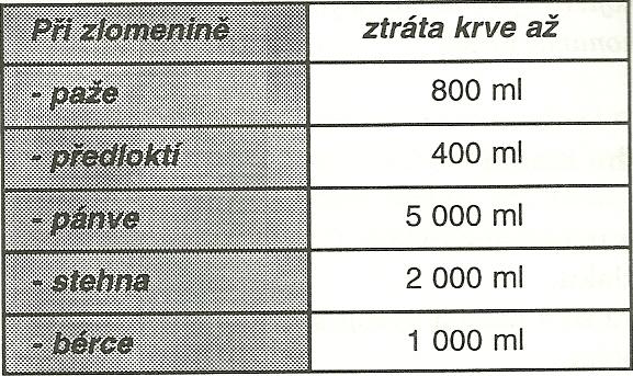 Příloha G - tlakové body Schéma tlakových bodů 1 - spánkový tlakový bod (a.temporalis) 2 - lícní tlakový bod (a. facialis) 3 - krční tlakový bod (a. carotis communis) 4 - podklíčkový tlakový bod (a.