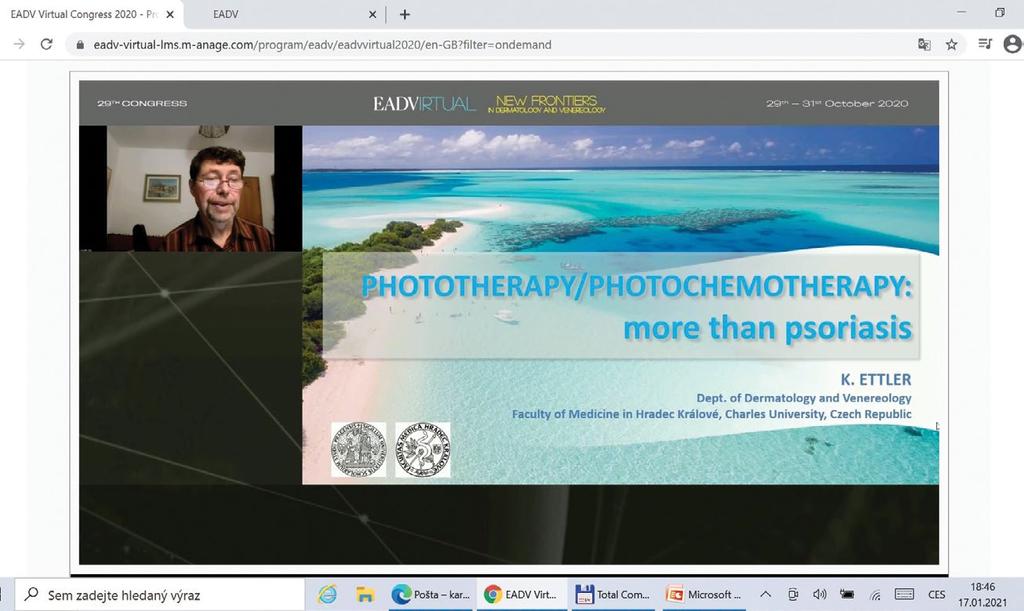 Obr. 2 Příklad prezentace na virtuálním kongresu EADV thiomersalem. Fotoalergické reakce se zdají být poddiagnostikované, a proto vyzývá k obezřetnosti. Prof.