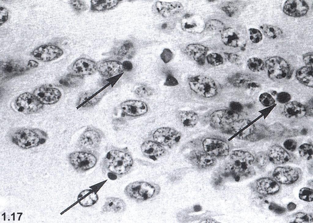 Rabies kopie Negriho