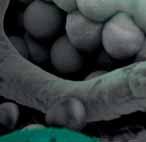 org/ Guidelines/Gastrointestinal-Cancers/Cancer-of-the-Pancreas/eUpdate-Treatment-Recommendations. Last accessed June 2020. 2. Okusaka T et al. Pancreas. 2020;49(3):326 33