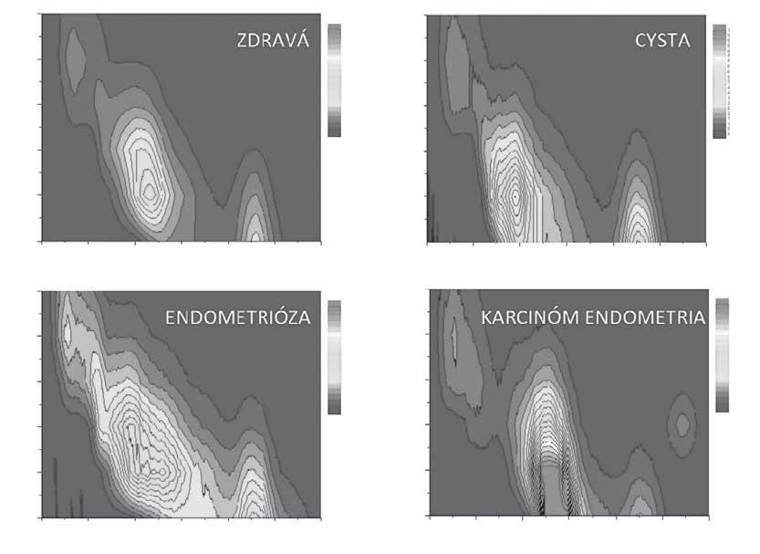 XX. GYNEKOLOGICKÁ ONKOLOGIE a jeho väzbové vlastnosti k DNA boli skúmané spektroskopickými metódami.