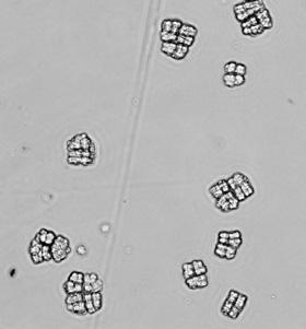 Mikrobiologie 1 koky a tyčinky neboli bacily (obr. 1).