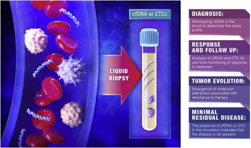 IHC HE Tekutá biopsie Tekutá biopsie Odběr 10ml krve, mutační