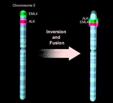 ALK (Anaplastická lymfomová kináza) chromozom 2 (2p23) fyziologická exprese ALK v prenatálním období vývoj nervové soustavy funkce v pozdějším období neznámá Přestavba