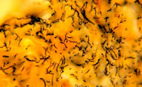 Syfilis (příjíce, lues) původce: Treponema pallidum lze prokázat stříbřením formy: získaná (= STD, 3 stádia) vrozená (transplacentární přenos)