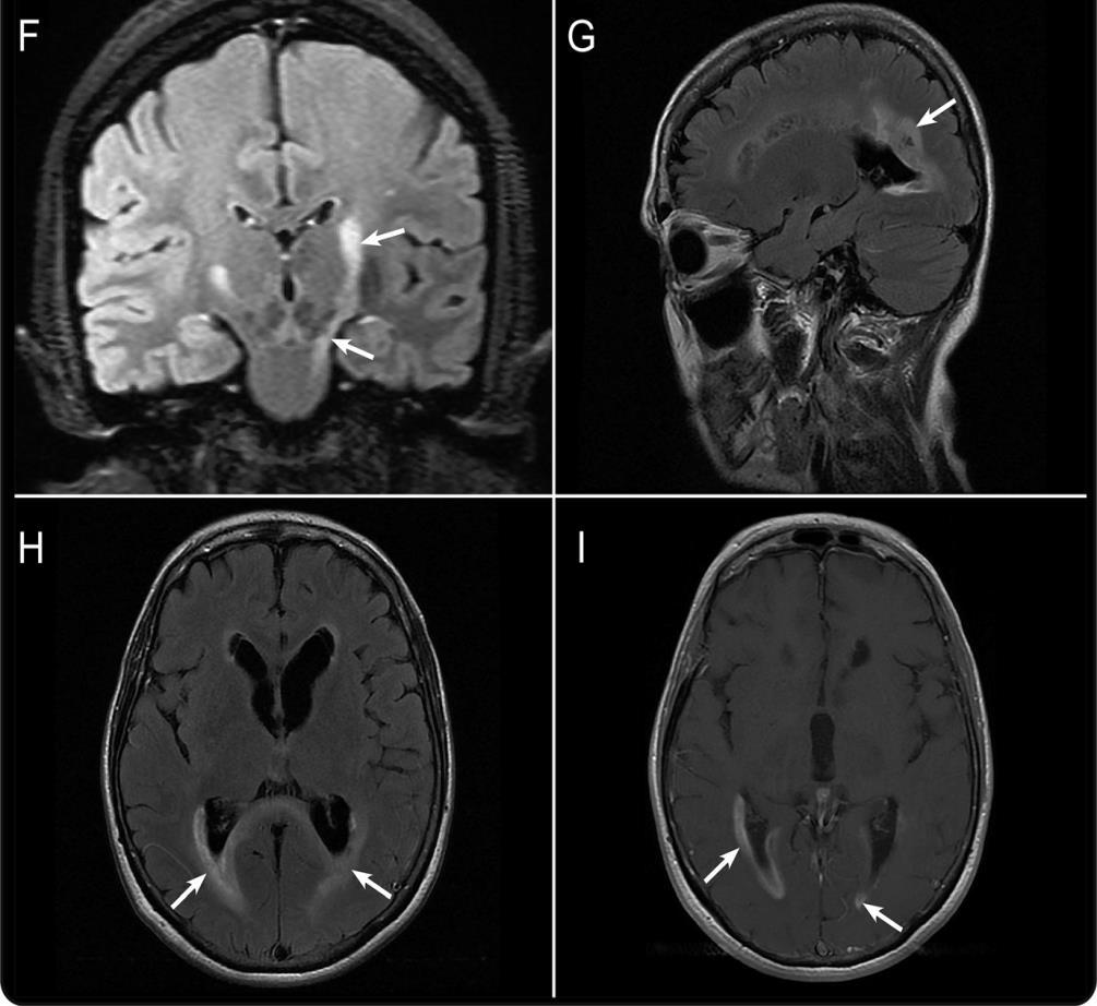 , International consensus diagnostic