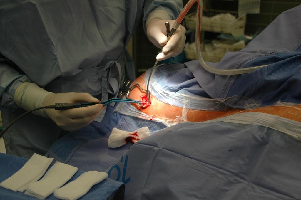Implantace