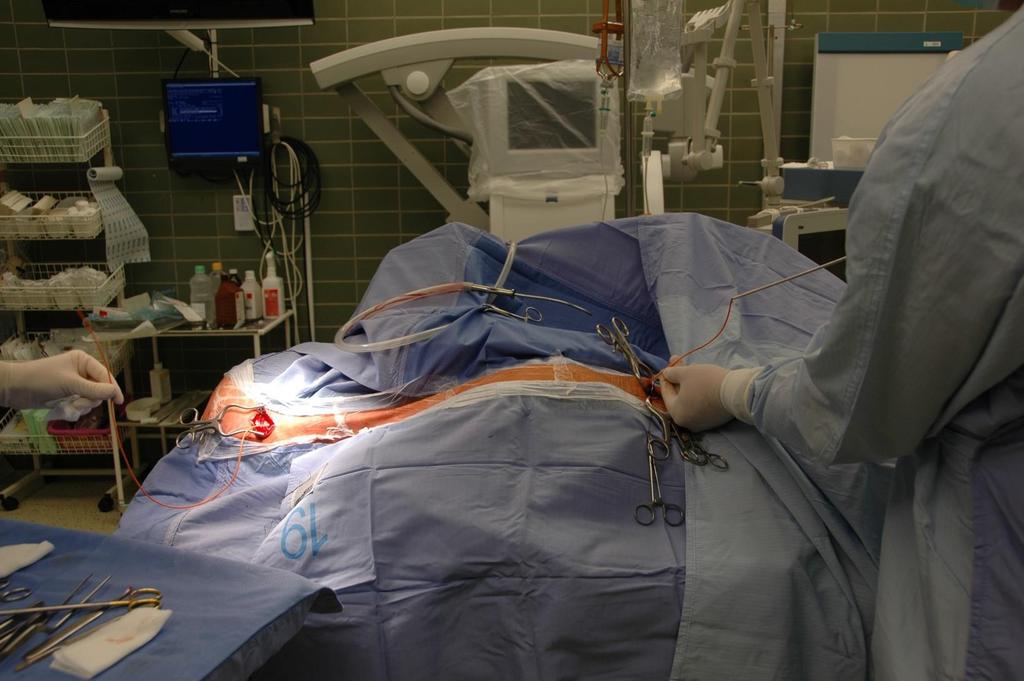 Implantace