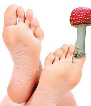 A to především u diabetiků, lidí s oslabenou imunitou nebo s cévní nedostatečností, kteří jsou více náchylní k bércovým vředům, diabetické noze, psoriáze a atopickému ekzému.