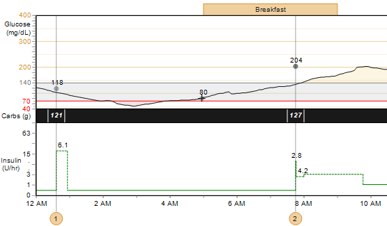 Glucose (Glykemie), Carbohydrates (Sacharidy) a Insulin (Inzulin) Tento graf poskytuje přehled hladin glykemie pacienta, příjmu sacharidů a užívání inzulinu v průběhu vybraného dne.