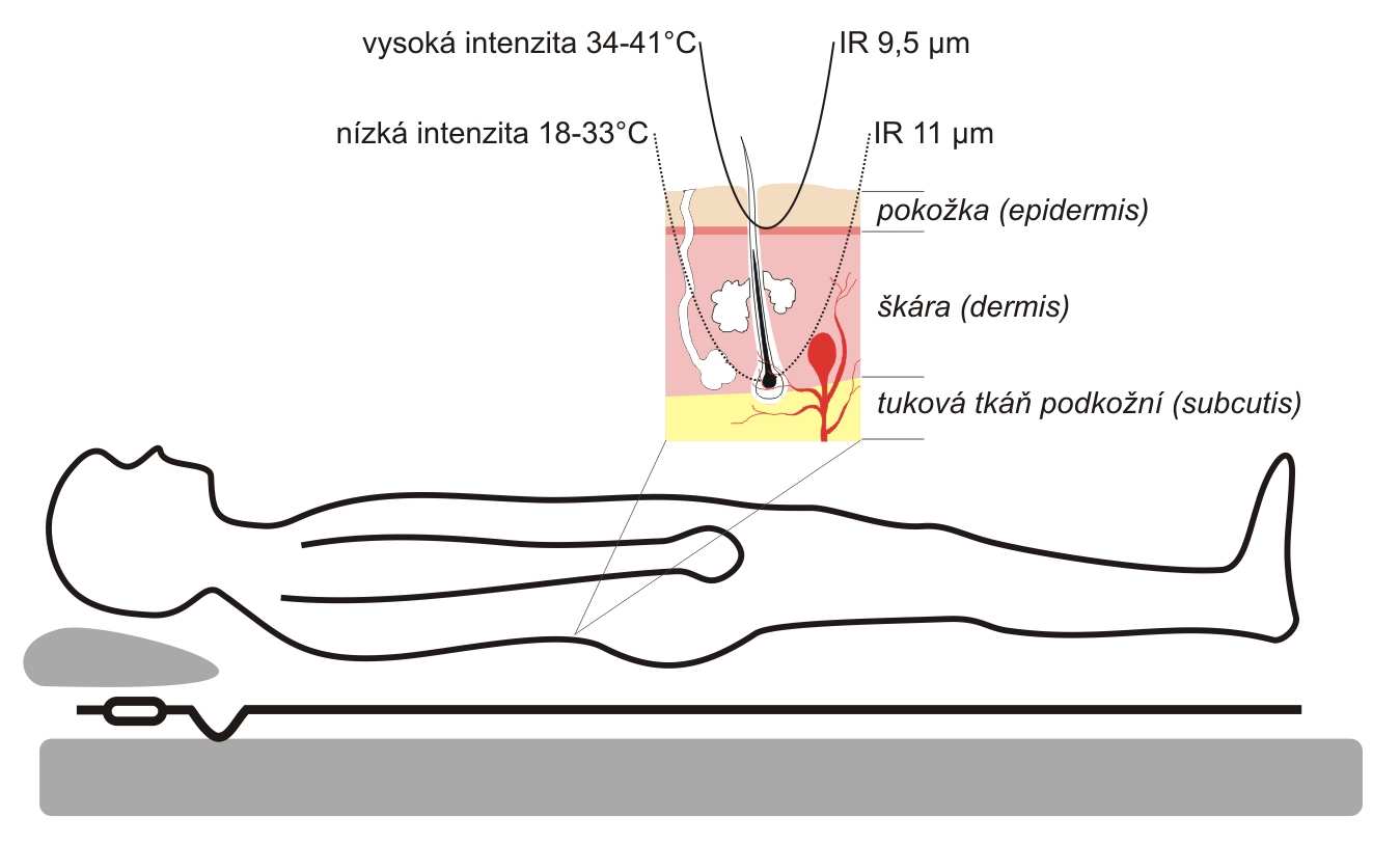 Na obrázku je schematické znázornění působení infračervených paprsků na lidský organismus Infračervená podložka se tedy nedá v podobné oblasti působení ani svoji strukturou a technickým řešením