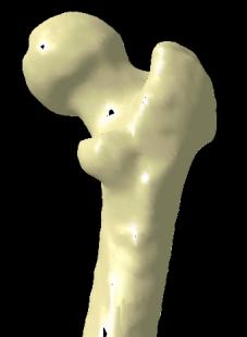 Výsledky jednoznačně ukazují, že kortikální kost dolní čelisti je hustější než horní čelisti a alveolární hřeben má vyšší hustotu spongiózní kosti než bazální