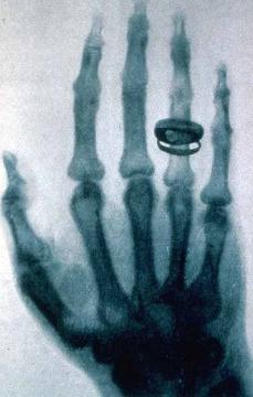 záření, které je do dnešních dob známo jako paprsky X (rentgenové paprsky). Celá metoda má na počest autora i stejné všeobecně známé jméno.