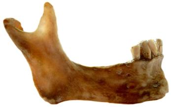 U modelování kosti je důležitá otázka rozlišení spongiózní a kortikální části kosti.