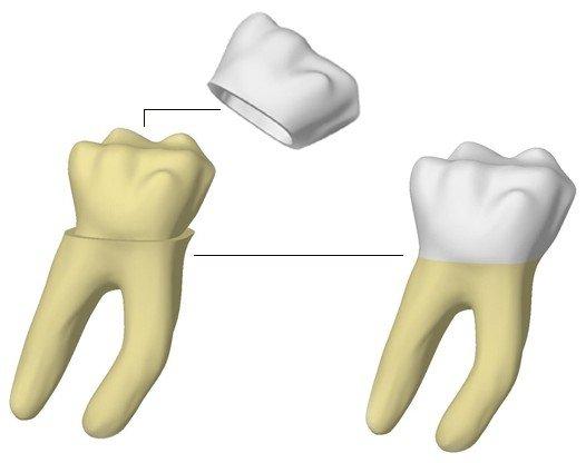 10. Prezentace a analýza vybraných úloh řešených výpočtovým modelováním 10.