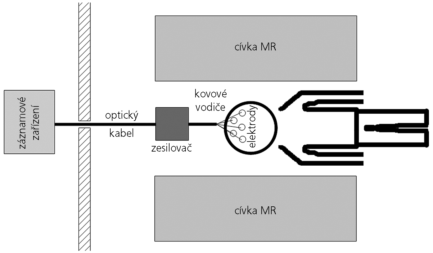 Úvod Multimodální neurozobrazovací techniky se používají a vyvíjejí paralelně se standardními unimodálními neurozobrazovacími technikami.