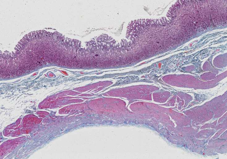 ŽALUDEK FUNDUS, CORPUS B12 jednovrstevný cylindrický hlenotvorný ep.